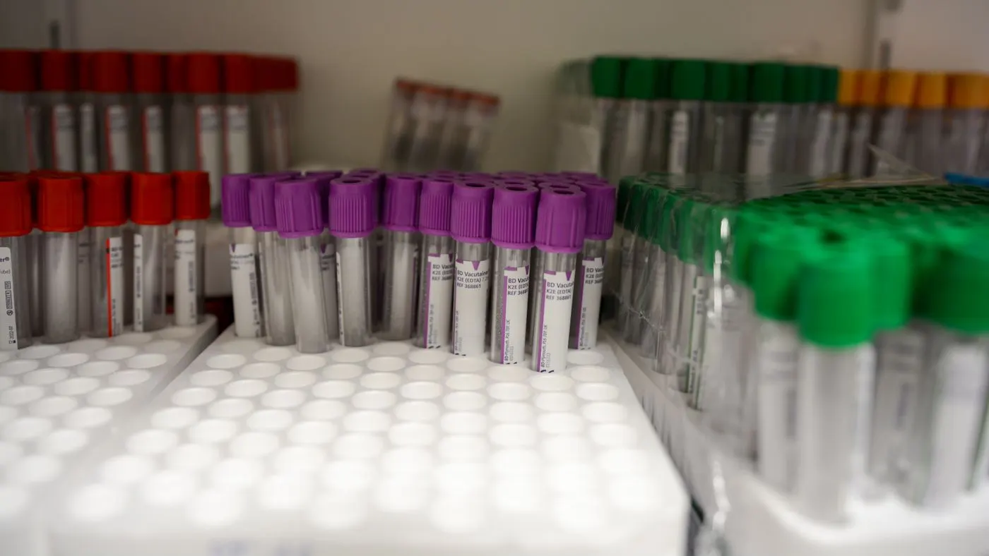 Tubos de extracción de sangre con tapas rojas, moradas y verdes en gradillas de un laboratorio: imagen para la guía sobre el examen de PSA o antígeno prostático