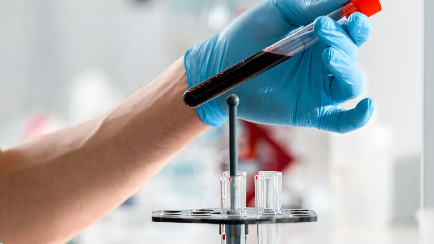 Mano con guante azul sosteniendo un tubo de sangre con tapa roja sobre un soporte de laboratorio: imagen para el examen de testosterona